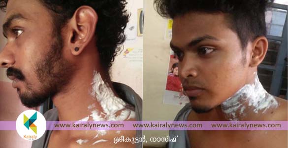 ഏറ്റുമാനൂര്‍ ഐടിഐയില്‍ അഞ്ച് വിദ്യാര്‍ത്ഥികള്‍ ഉള്‍പ്പെടെ എട്ട് പേര്‍ക്ക് കോട്ടയത്ത് സൂര്യതാപം