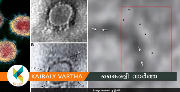 കോവിഡ് 19 വൈറസിന്‍റെ ആദ്യ ഇലക്ട്രോണ്‍ മൈക്രോസ്‌കോപ് ചിത്രം പുറത്തുവിട്ട് ഇന്ത്യ