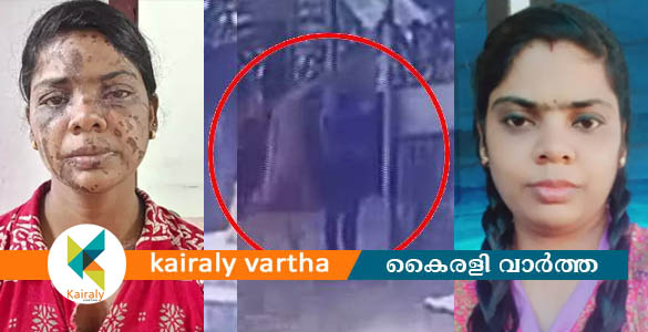 പ്രണയം നിരസിച്ച യുവാവിന് നേരെ ആസിഡ് ആക്രമണം; യുവാവിന്‍റെ കാഴ്ച നഷ്ടപ്പെട്ടു