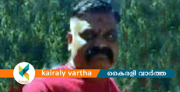 ഭാര്യയെ വെട്ടിക്കൊല്ലാന്‍ ശ്രമിച്ച കേസില്‍ റൗഡിലിസ്റ്റിലുള്ള 'കോടാലി ഷിജു' പിടിയില്‍