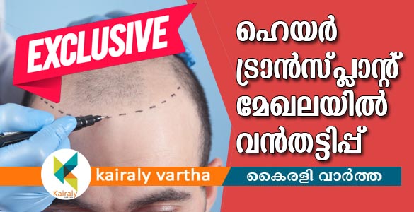 ഹെയര്‍ ട്രാന്‍സ്പ്ലാന്‍റേഷന്‍ രംഗത്ത് വ്യാജചികിത്സയുമായി ദന്തഡോക്ടര്‍മാര്‍