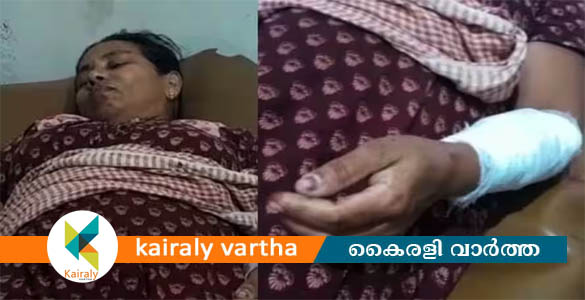 ശ്രീകണ്ഠാപുരത്ത് കാട്ടുപന്നിയുടെ ആക്രമണത്തിൽ വീട്ടമ്മക്ക് പരിക്ക്