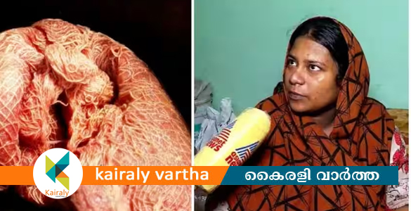 ശസ്ത്രക്രിയക്കിടെ വയറ്റില്‍ പഞ്ഞി മറന്നുവച്ചു; പരാതിയുമായി പാലക്കാട് സ്വദേശി