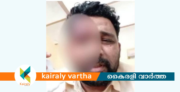 കെഎസ്ആര്‍ടിസി ഡ്രൈവറുടെ തലയടിച്ച് പൊട്ടിച്ചു; സ്റ്റേഷന്‍ മാസ്റ്റര്‍ കസ്റ്റഡിയില്‍