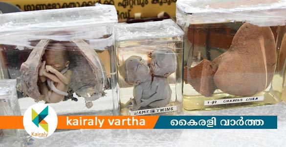 കളിയും കാര്യവുമായി വനിതാ ശിശുവികസന വകുപ്പ് സ്റ്റാൾ
