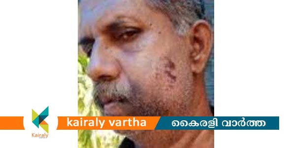 നാലാം ക്ലാസില്‍ പഠിക്കുമ്പോള്‍ അടിച്ചു, 62ാം വയസില്‍ തിരിച്ചടി; പല്ലുകൾ അടിച്ചു കൊഴിച്ചു