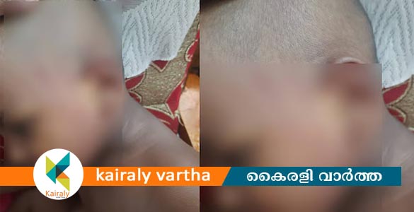 തിരുവനന്തപുരത്ത് കുഞ്ഞിനെ മര്‍ദിച്ച അങ്കണവാടി അധ്യാപികക്കെതിരെ കേസ്