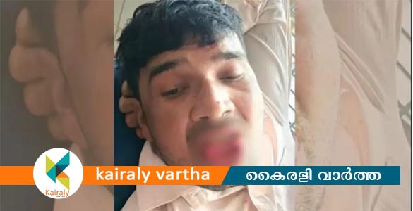 യുവതിയെ ബലമായി ചുംബിച്ചു; മുന്‍ കാമുകന്‍റെ നാക്ക് കടിച്ചു മുറിച്ചു