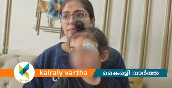 മേശയുടെ കോര്‍ണറില്‍ ഇടിച്ച് തലമുറിഞ്ഞു; കുട്ടിയുടെ മുറിവ് ഫെവിക്വിക് ഉപയോ​ഗിച്ച് ഒട്ടിച്ച് ഡോക്ടർ