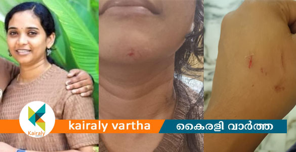ആറ്റുകാലിൽ യുവതി ജീവനൊടുക്കി; ഭര്&zwj;തൃപീഡനമെന്ന ആരോപണവുമായി കുടുംബം